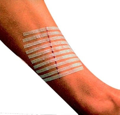 Parche Sterip- Strip 12mmx100mm